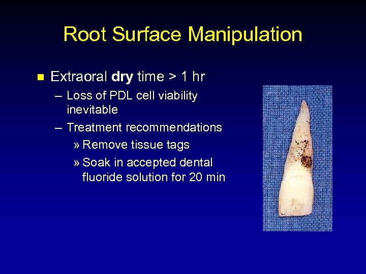 Root Surface Manipulation n Extraoral dry time > 1 hr – Loss of PDL