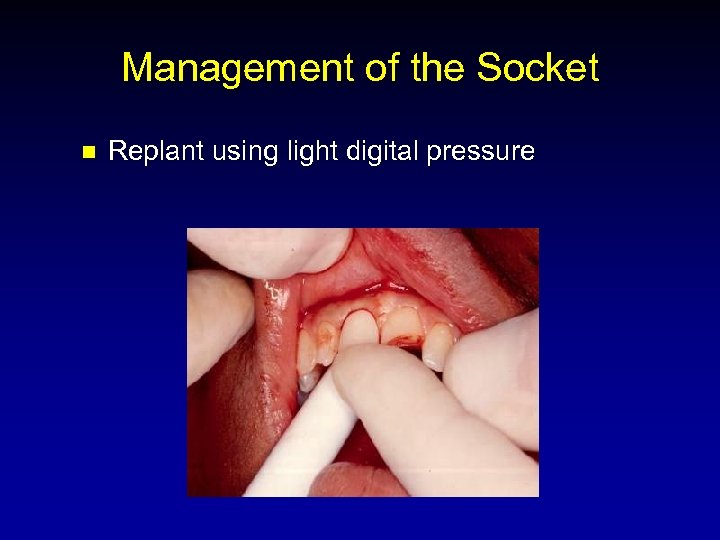 Management of the Socket n Replant using light digital pressure 