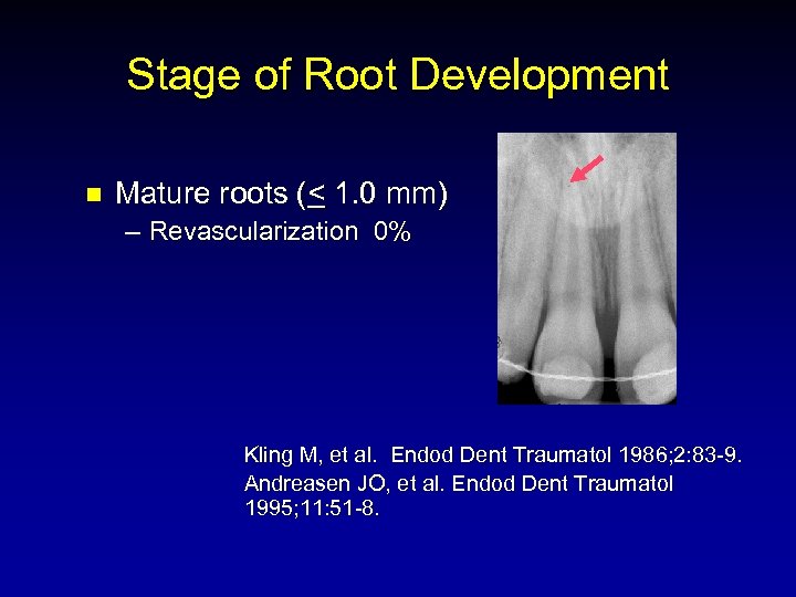 Stage of Root Development n Mature roots (< 1. 0 mm) – Revascularization 0%