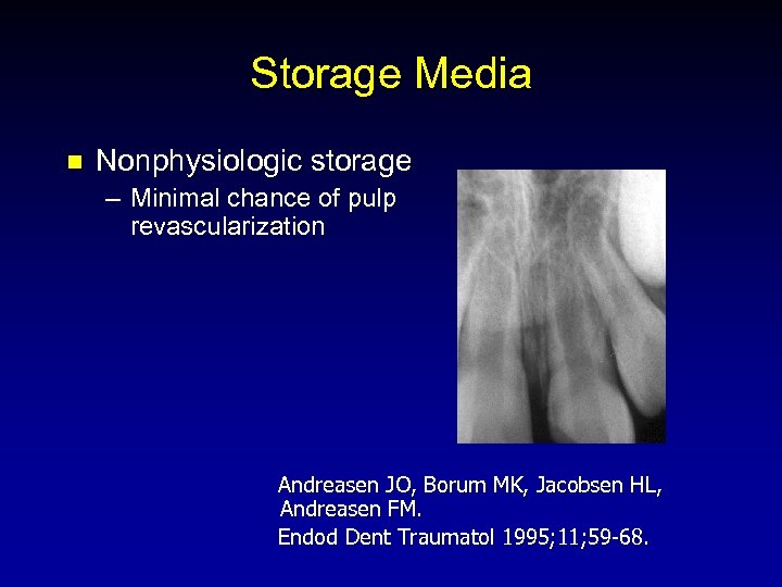Storage Media n Nonphysiologic storage – Minimal chance of pulp revascularization Andreasen JO, Borum