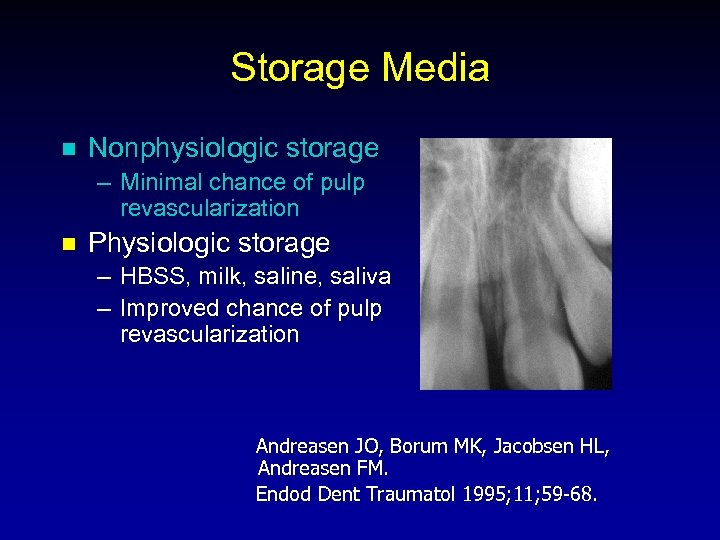 Storage Media n Nonphysiologic storage – Minimal chance of pulp revascularization n Physiologic storage
