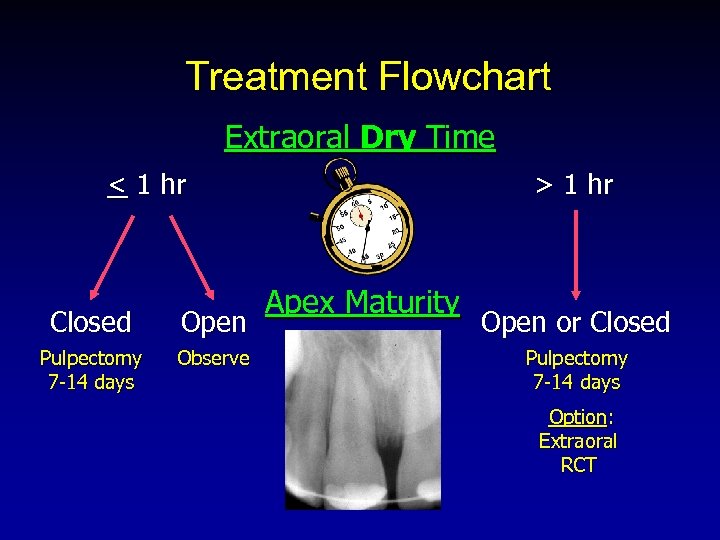 Treatment Flowchart Extraoral Dry Time < 1 hr Closed Open Pulpectomy 7 -14 days
