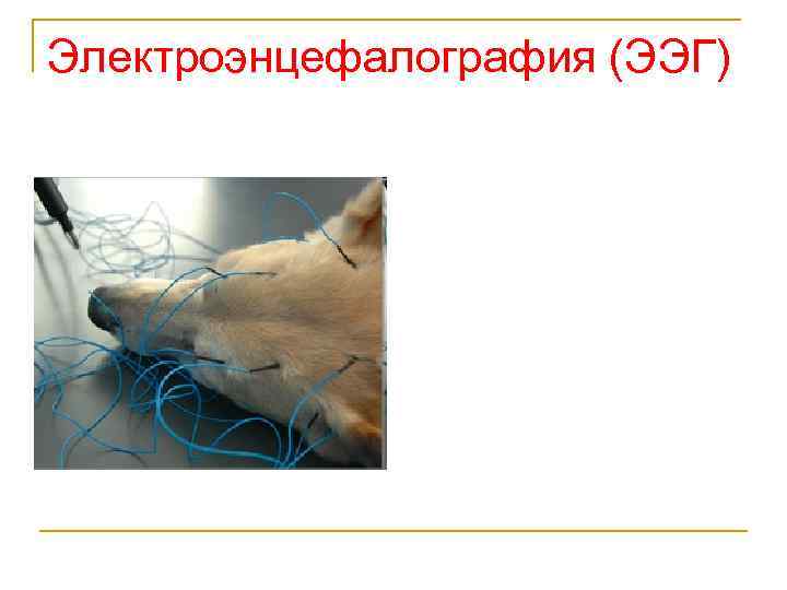 Электроэнцефалография (ЭЭГ) 