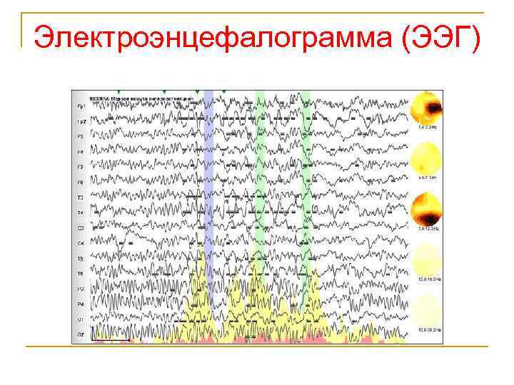 Схема измерительного канала электроэнцефалографа