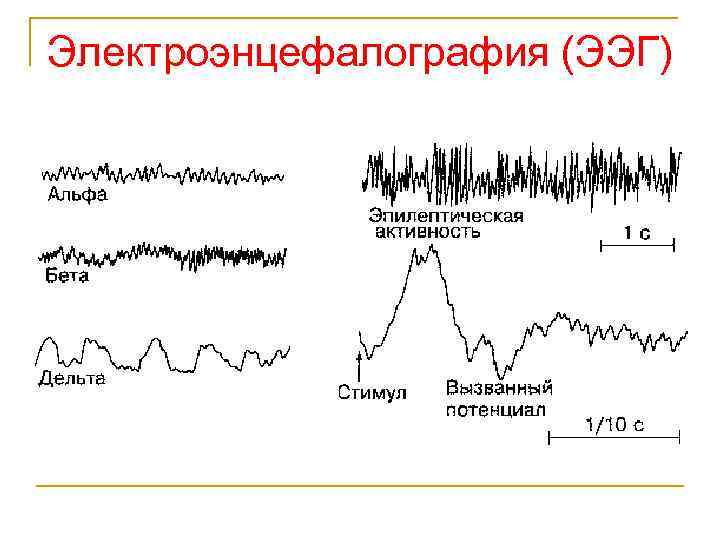 Электроэнцефалография (ЭЭГ) 