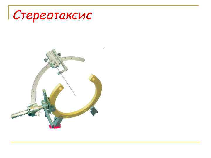 Стереотаксис 