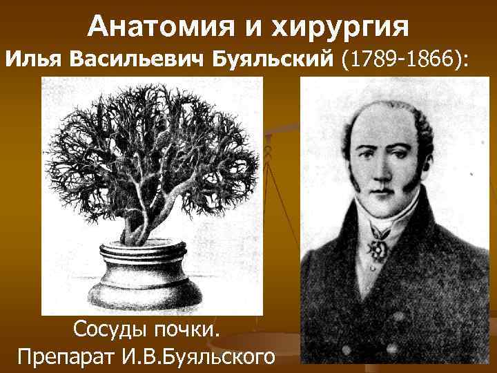 Анатомия и хирургия Илья Васильевич Буяльский (1789 -1866): Сосуды почки. Препарат И. В. Буяльского