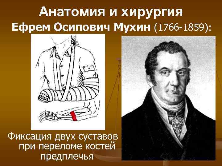 Анатомия и хирургия Ефрем Осипович Мухин (1766 -1859): Фиксация двух суставов при переломе костей