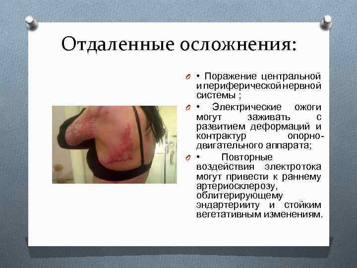 Отдаленные осложнения: O • Поражение центральной и периферической нервной системы ; O • Электрические
