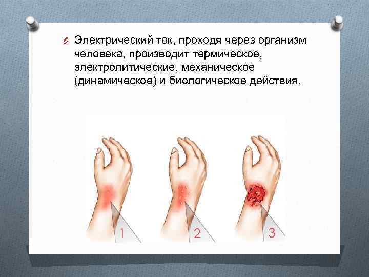 O Электрический ток, проходя через организм человека, производит термическое, электролитические, механическое (динамическое) и биологическое