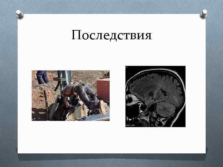 Последствия 