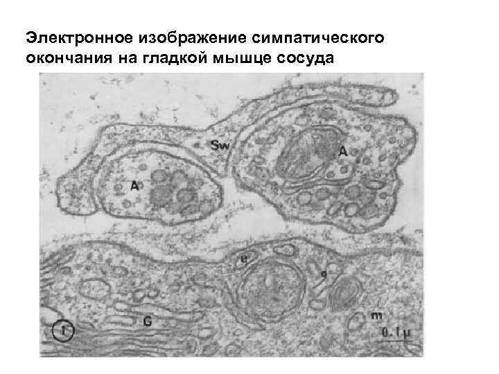 Электронное изображение симпатического окончания на гладкой мышце сосуда 