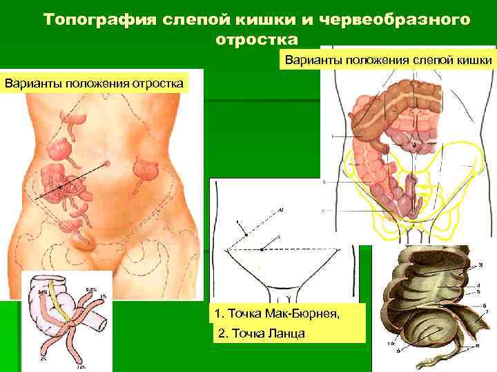 Топография слепой кишки и червеобразного отростка Варианты положения слепой кишки Варианты положения отростка 1.