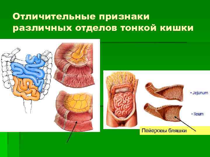 Отличительные признаки различных отделов тонкой кишки Пейеровы бляшки 