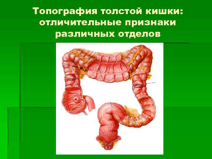 Топография толстой кишки: отличительные признаки различных отделов 