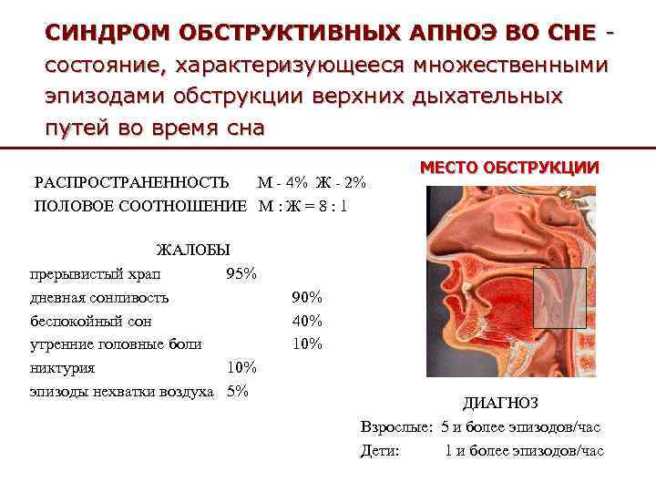 СИНДРОМ ОБСТРУКТИВНЫХ АПНОЭ ВО СНЕ состояние, характеризующееся множественными эпизодами обструкции верхних дыхательных путей во