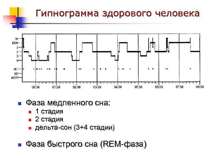 Гипнограмма здорового человека n Фаза медленного сна: n n 1 стадия 2 стадия дельта-сон