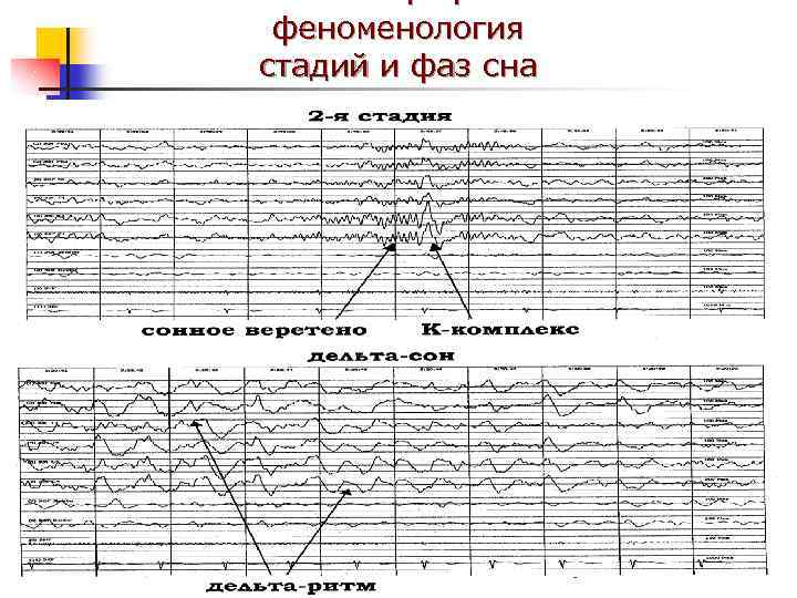 феноменология стадий и фаз сна 
