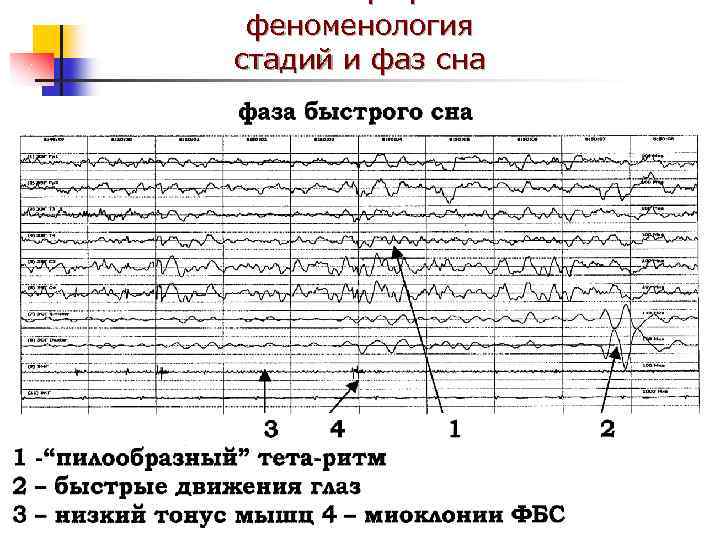 феноменология стадий и фаз сна 