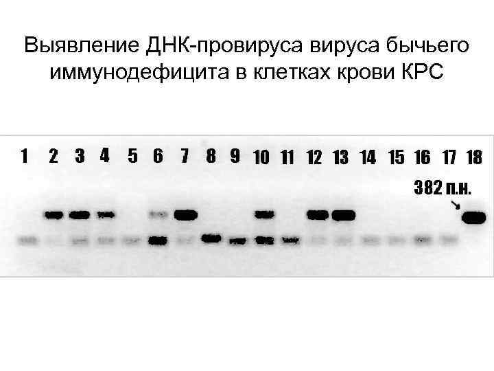 Выявление ДНК-провируса бычьего иммунодефицита в клетках крови КРС 