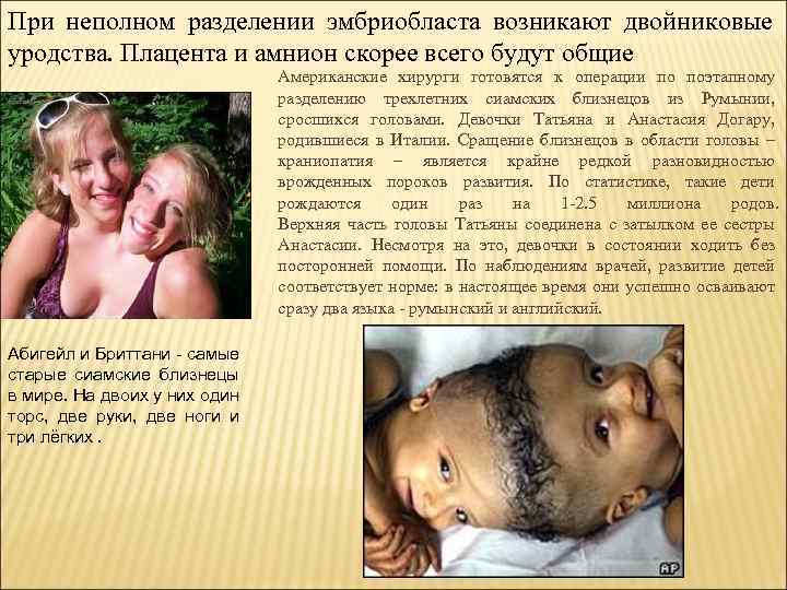 При неполном разделении эмбриобласта возникают двойниковые уродства. Плацента и амнион скорее всего будут общие