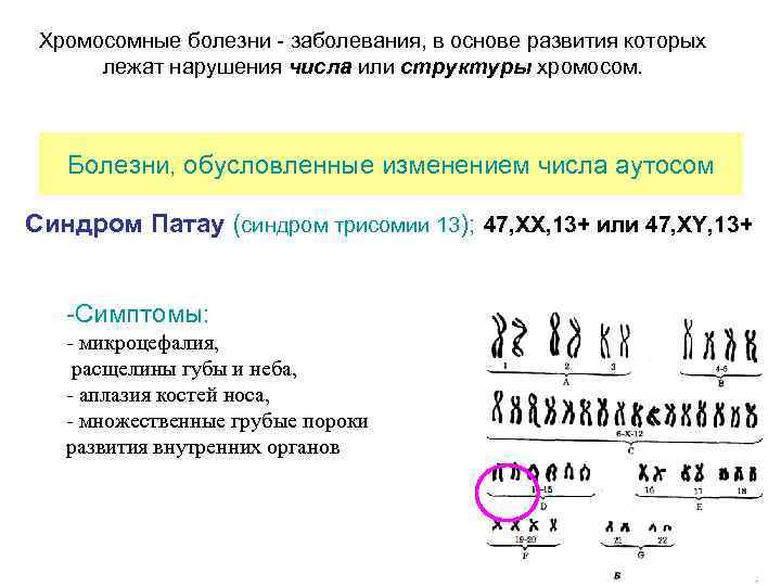 Аномалии развития аутосом