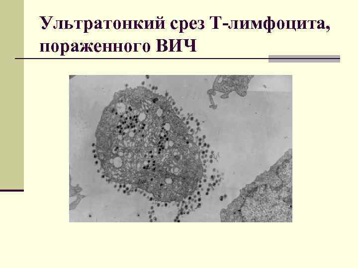 Ультратонкий срез Т-лимфоцита, пораженного ВИЧ 