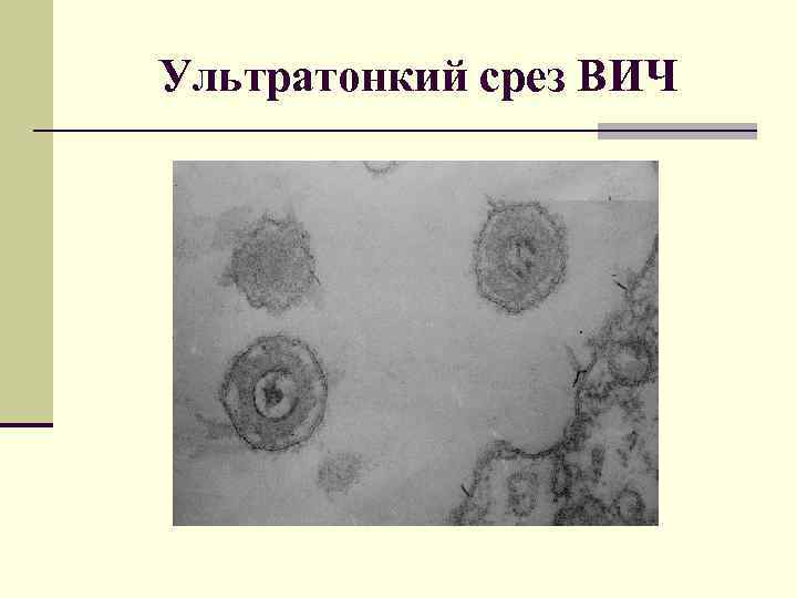 Ультратонкий срез ВИЧ 