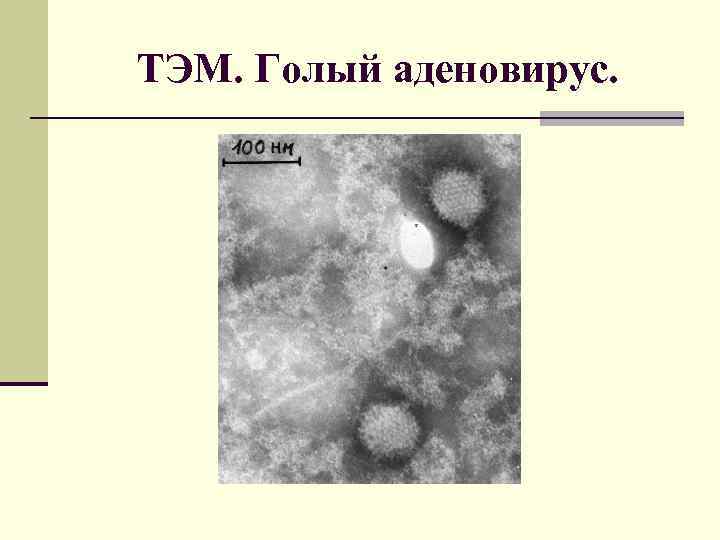 ТЭМ. Голый аденовирус. 