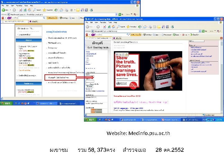 Website: Medinfo. psu. ac. th ผเขาชม รวม 58, 373ครง สำรวจเมอ 28 ตค. 2552 