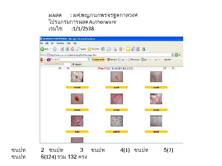 ผผลต : ผศ. พญ. กนกพร จรฐตกาลวงศ โปรแกรมการผลต Authorware เรมใช : 1/1/2538 ชนปท 2 ชนปท