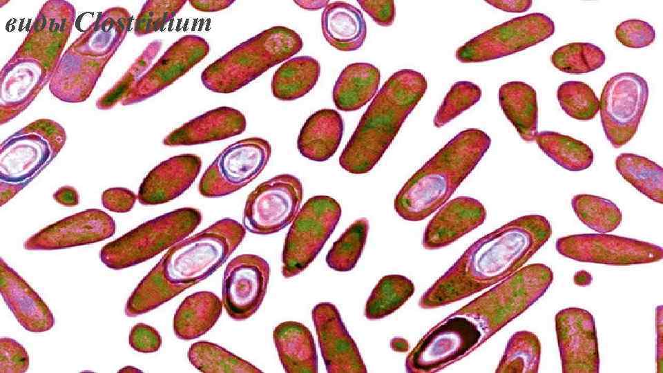 виды Clostridium 