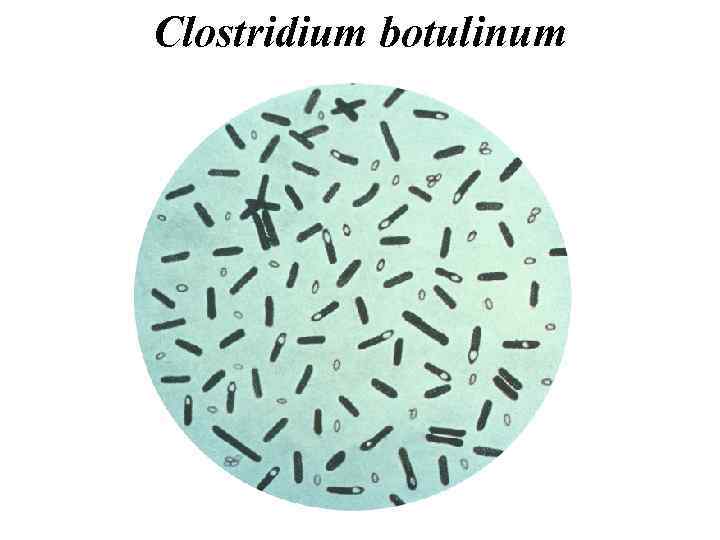 Clostridium botulinum 