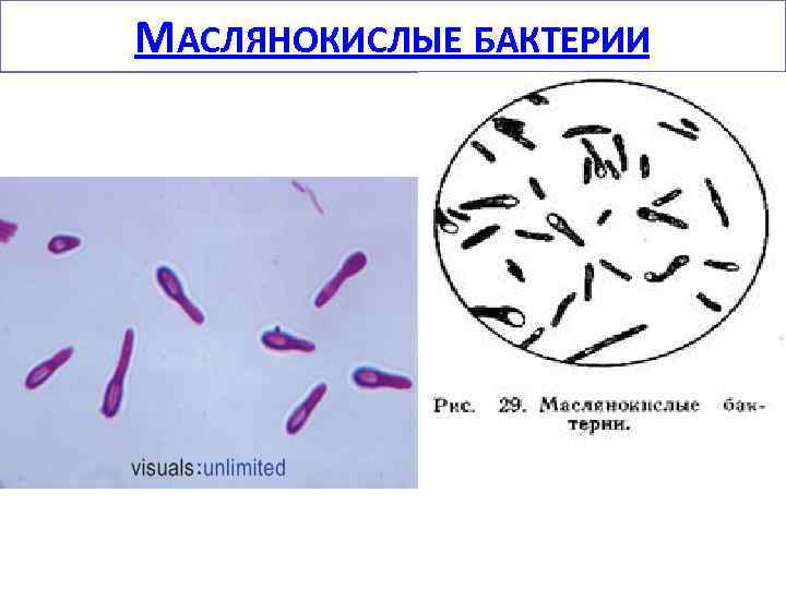 МАСЛЯНОКИСЛЫЕ БАКТЕРИИ 