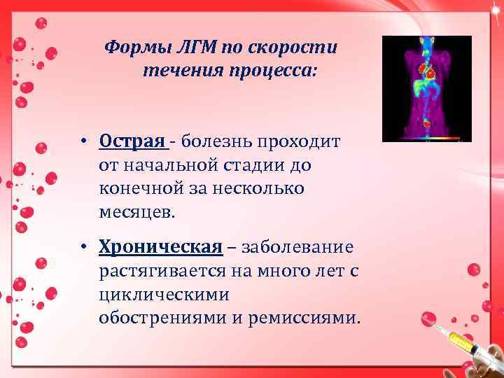 Формы ЛГМ по скорости течения процесса: • Острая - болезнь проходит от начальной стадии