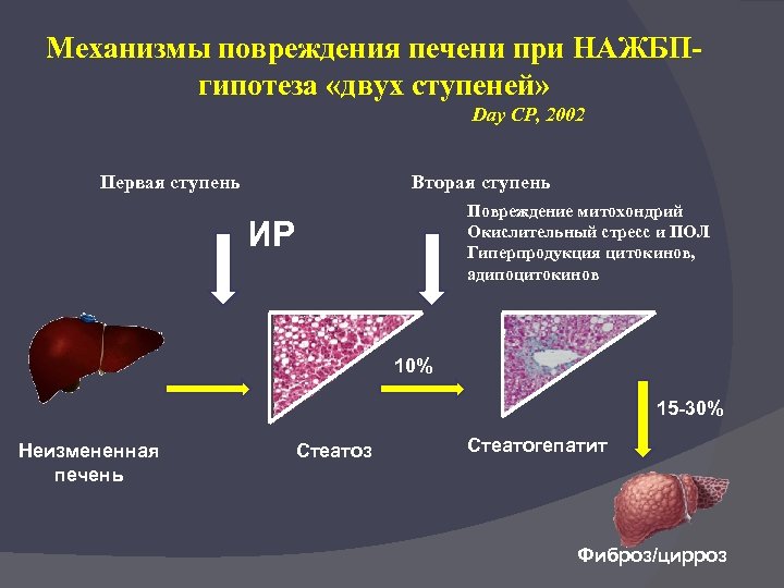 Механизмы повреждения печени при НАЖБПгипотеза «двух ступеней» Day CP, 2002 Первая ступень Вторая ступень