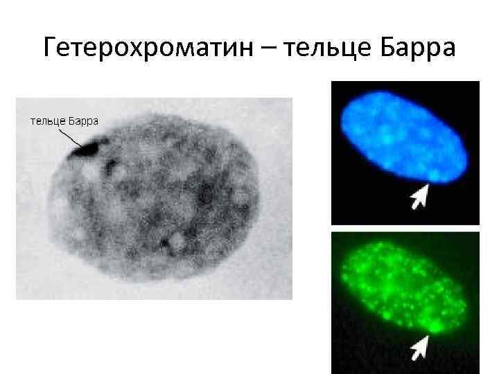 Тельце барра в каких клетках