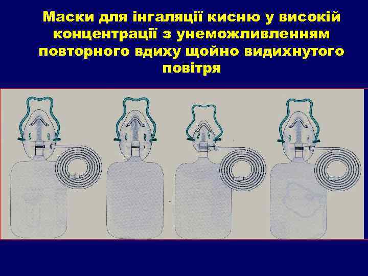 Маски для інгаляції кисню у високій концентрації з унеможливленням повторного вдиху щойно видихнутого повітря