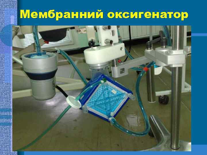Мембранний оксигенатор 