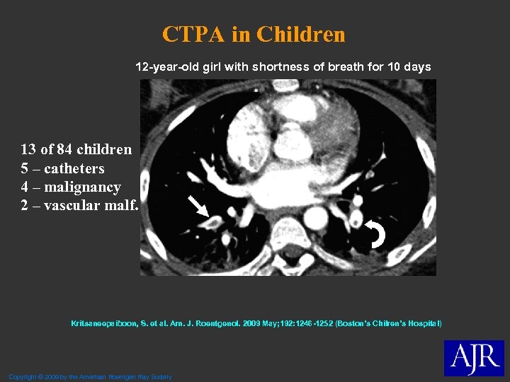 CTPA in Children 12 -year-old girl with shortness of breath for 10 days 13