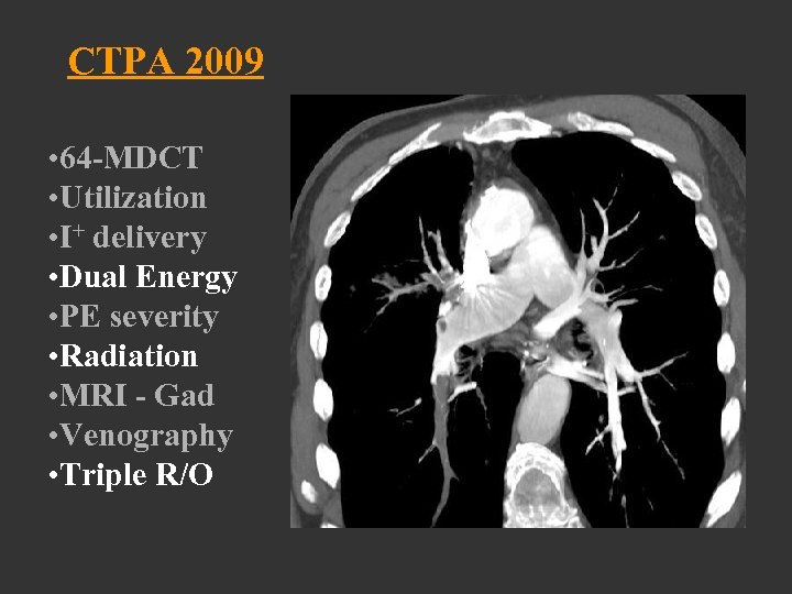 CTPA 2009 • 64 -MDCT • Utilization • I+ delivery • Dual Energy •