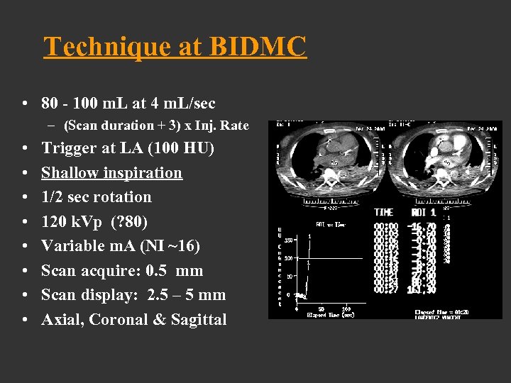Technique at BIDMC • 80 - 100 m. L at 4 m. L/sec –