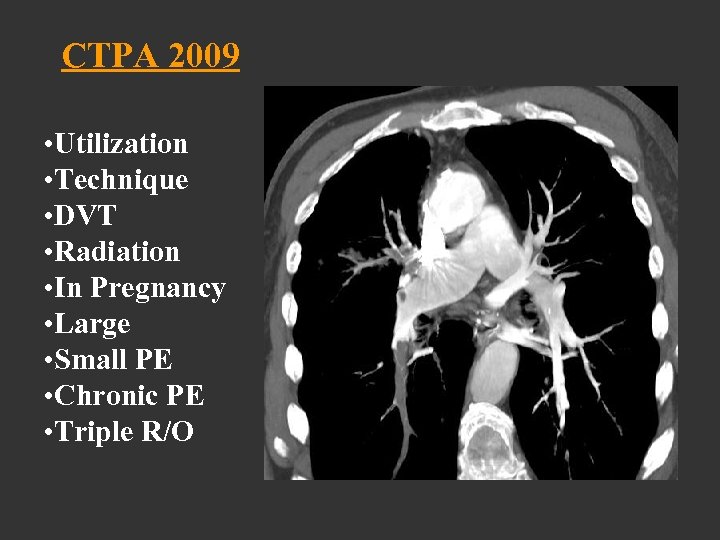 CTPA 2009 • Utilization • Technique • DVT • Radiation • In Pregnancy •