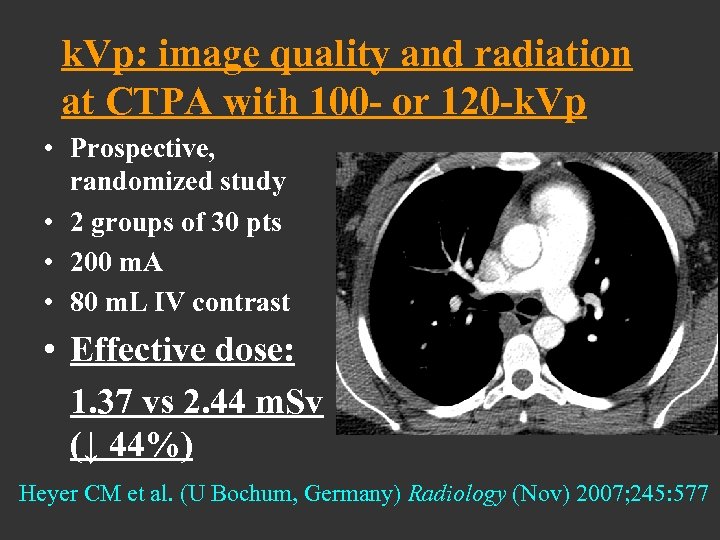 k. Vp: image quality and radiation at CTPA with 100 - or 120 -k.