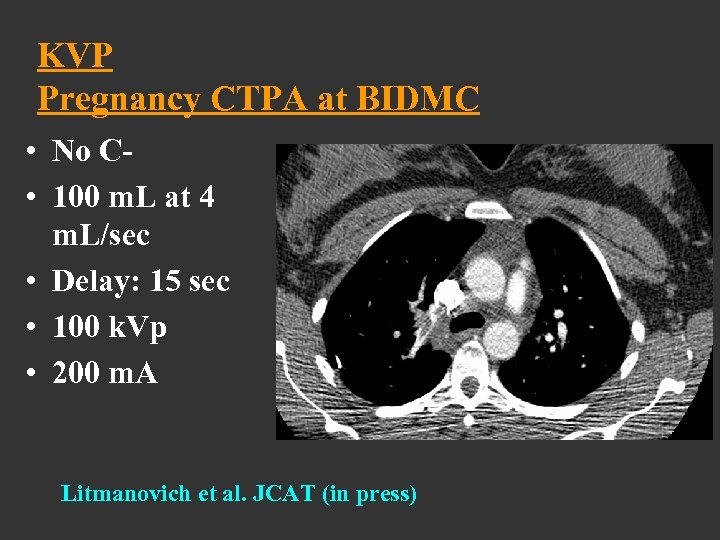 KVP Pregnancy CTPA at BIDMC • No C • 100 m. L at 4