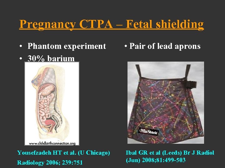 Pregnancy CTPA – Fetal shielding • Phantom experiment • 30% barium • Pair of