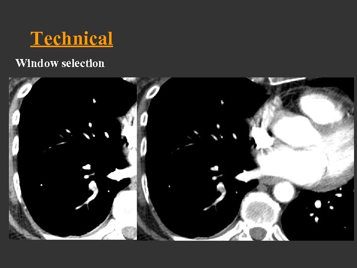Technical Window selection 