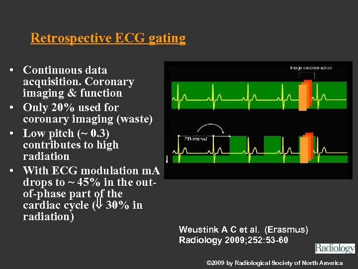 Retrospective ECG gating • Continuous data acquisition. Coronary imaging & function • Only 20%