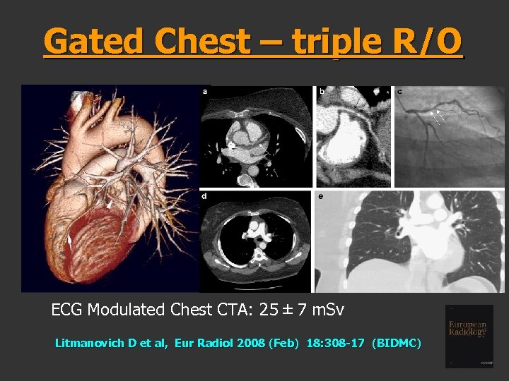 Gated Chest – triple R/O ECG Modulated Chest CTA: 25 ± 7 m. Sv Litmanovich D