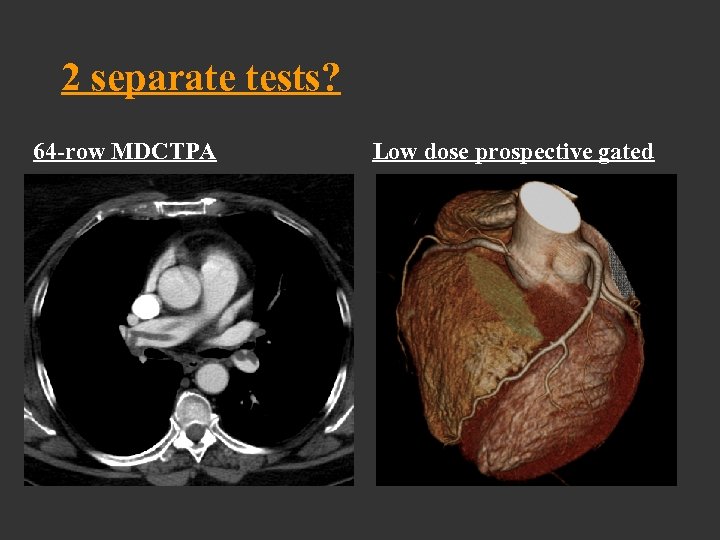 2 separate tests? 64 -row MDCTPA Low dose prospective gated 